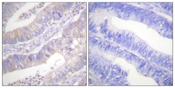 CFTR rabbit pAb Antibody