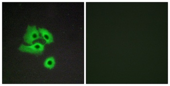 Chemokine Receptor D6 rabbit pAb Antibody