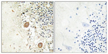 Chr-A rabbit pAb Antibody