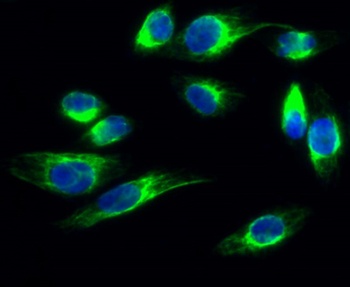 Claudin-1 rabbit pAb Antibody