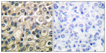 Claudin-1 rabbit pAb Antibody