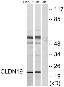 Claudin-19 rabbit pAb Antibody
