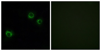Claudin-6 rabbit pAb Antibody