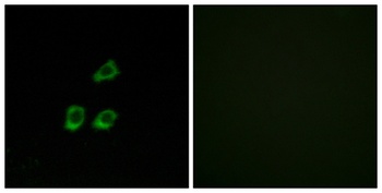 CLC-4 rabbit pAb Antibody