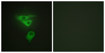CLP36 rabbit pAb Antibody