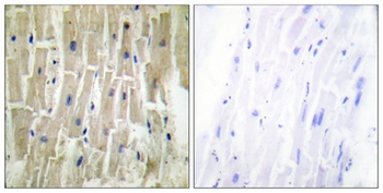 CLP36 rabbit pAb Antibody