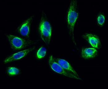 Clusterin rabbit pAb Antibody