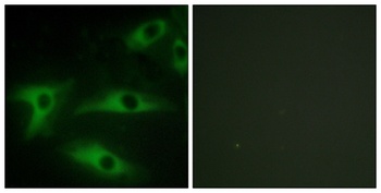 COL1A2 rabbit pAb Antibody