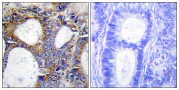 COL1A2 rabbit pAb Antibody