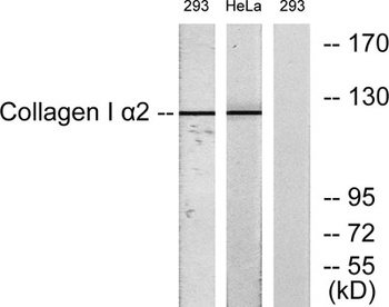 COL1A2 rabbit pAb Antibody