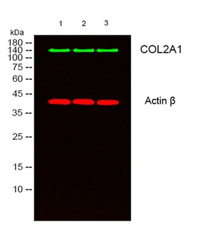 COL2A1 rabbit pAb Antibody