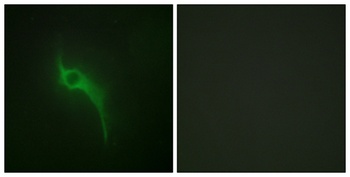 COL5A1 rabbit pAb Antibody