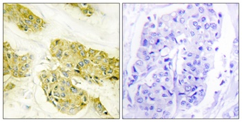 COL5A3 rabbit pAb Antibody