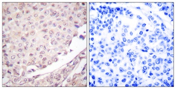CUL-1 rabbit pAb Antibody