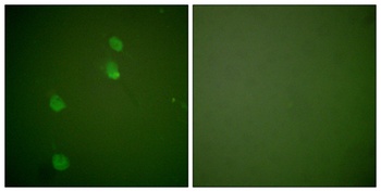 CUL-2 rabbit pAb Antibody