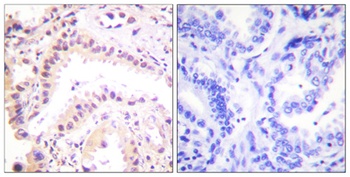 CUL-2 rabbit pAb Antibody