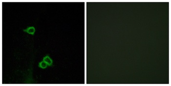 CXCR-7 rabbit pAb Antibody