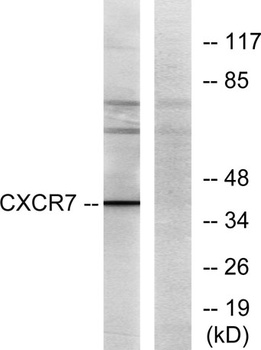 CXCR-7 rabbit pAb Antibody
