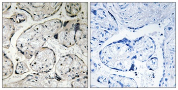 CYB5R3 rabbit pAb Antibody