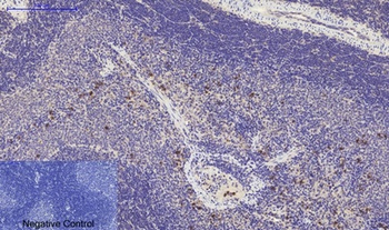 Cyclin D1 rabbit pAb Antibody
