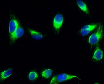 CYP19A1 rabbit pAb Antibody