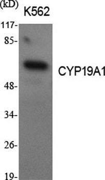 CYP19A1 rabbit pAb Antibody