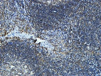 CYP19A1 rabbit pAb Antibody