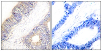 Cystatin A rabbit pAb Antibody
