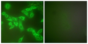 Cystatin B rabbit pAb Antibody