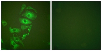 Cytokeratin 17 rabbit pAb Antibody