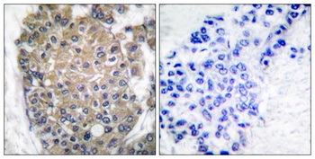 Cytokeratin 17 rabbit pAb Antibody