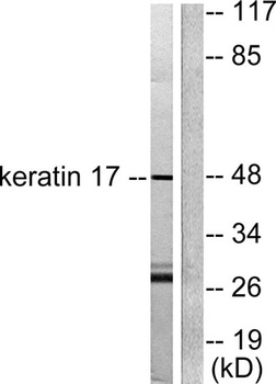 Cytokeratin 17 rabbit pAb Antibody
