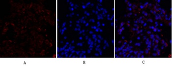 Cytokeratin 18 rabbit pAb Antibody