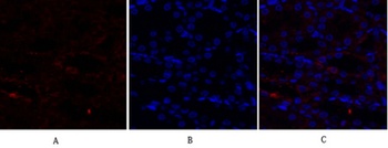 Cytokeratin 18 rabbit pAb Antibody