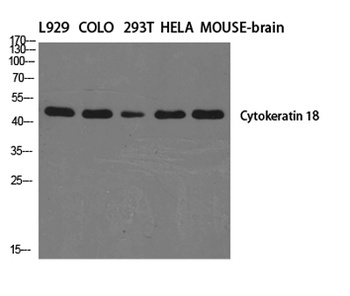 Cytokeratin 18 rabbit pAb Antibody