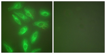 Cytokeratin 18 rabbit pAb Antibody