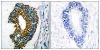 Cytokeratin 18 rabbit pAb Antibody