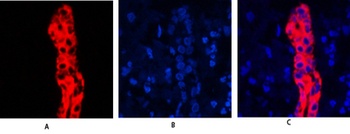 Cytokeratin 19 rabbit pAb Antibody