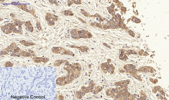 Cytokeratin 19 rabbit pAb Antibody