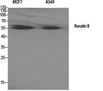 Cytokeratin 8 rabbit pAb Antibody