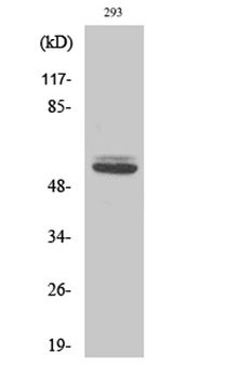 Cytokeratin 8 rabbit pAb Antibody