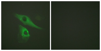 Cytokeratin 8 rabbit pAb Antibody