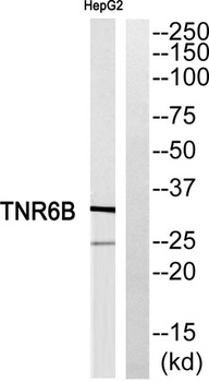 DcR3 rabbit pAb Antibody