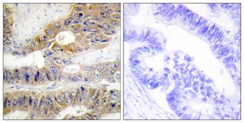 DcR3 rabbit pAb Antibody