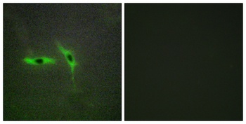 DcR3 rabbit pAb Antibody