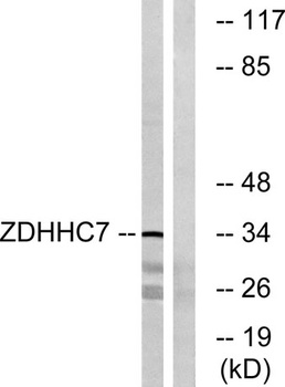 DHHC-7 rabbit pAb Antibody