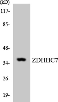 DHHC-7 rabbit pAb Antibody