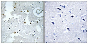 DJ-1 rabbit pAb Antibody
