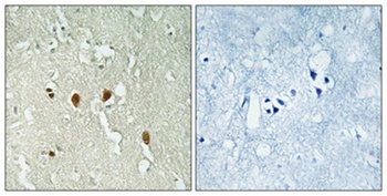 DJ-1 rabbit pAb Antibody