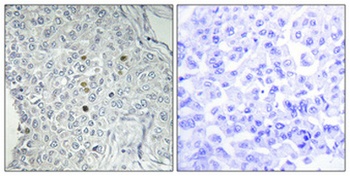 DPF2 rabbit pAb Antibody